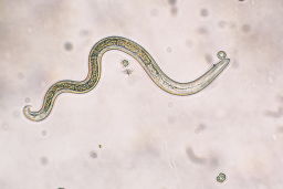 roundworm - Claire Benson blog.png